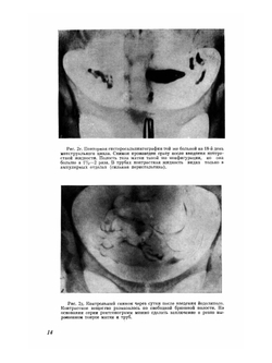 Атлас гистеросальпингографии | М.М. Абрамова
