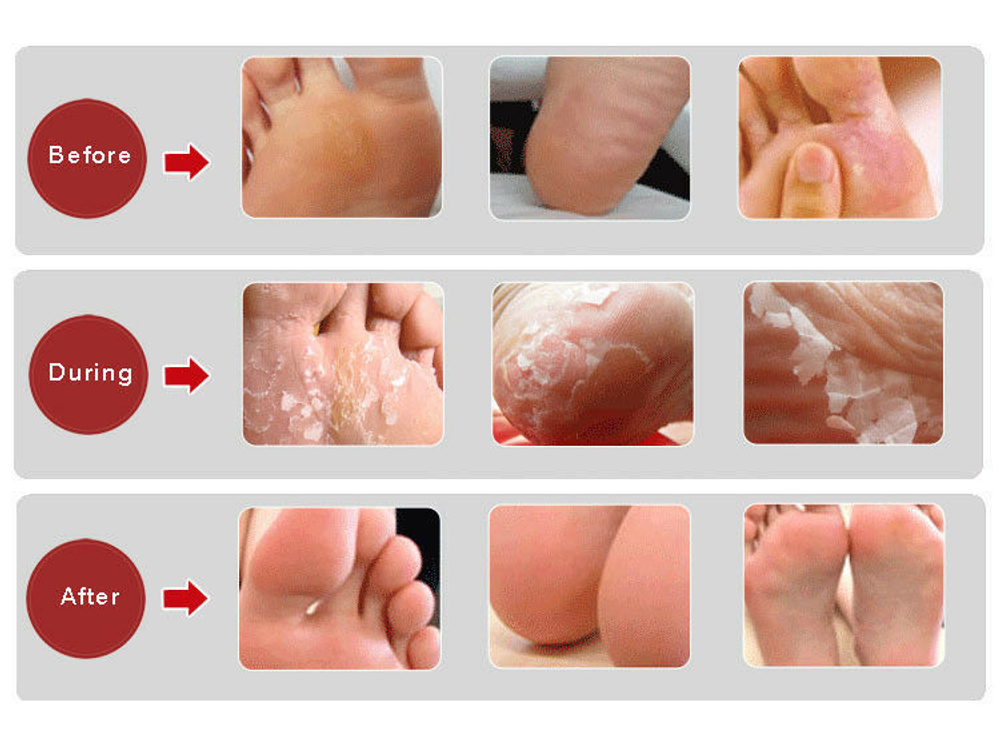 Eyenlip Baby Foot Peeling Mask носочки для педикюра