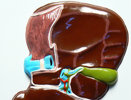 Барельефная модель Печень. Висцеральная поверхность