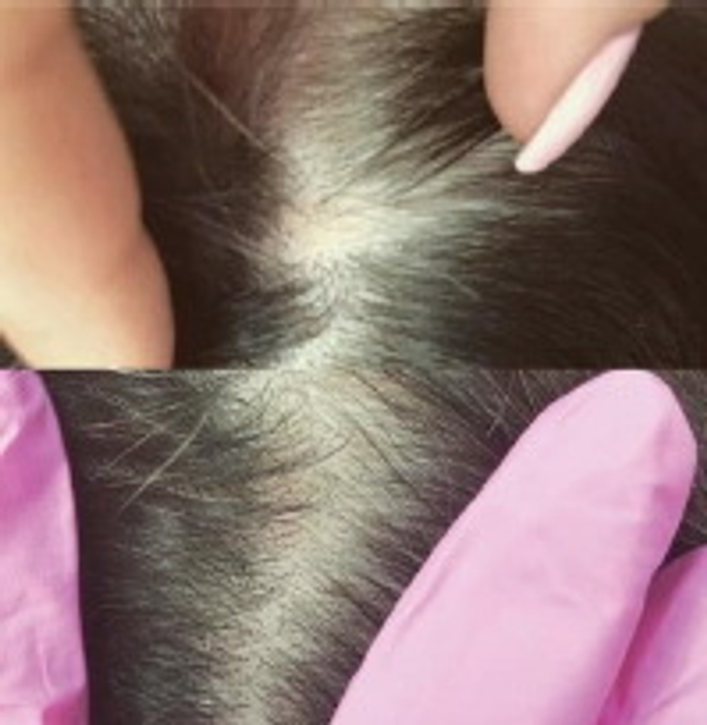 Hair Forest Ampoule Eldermafill | Восстановление волос