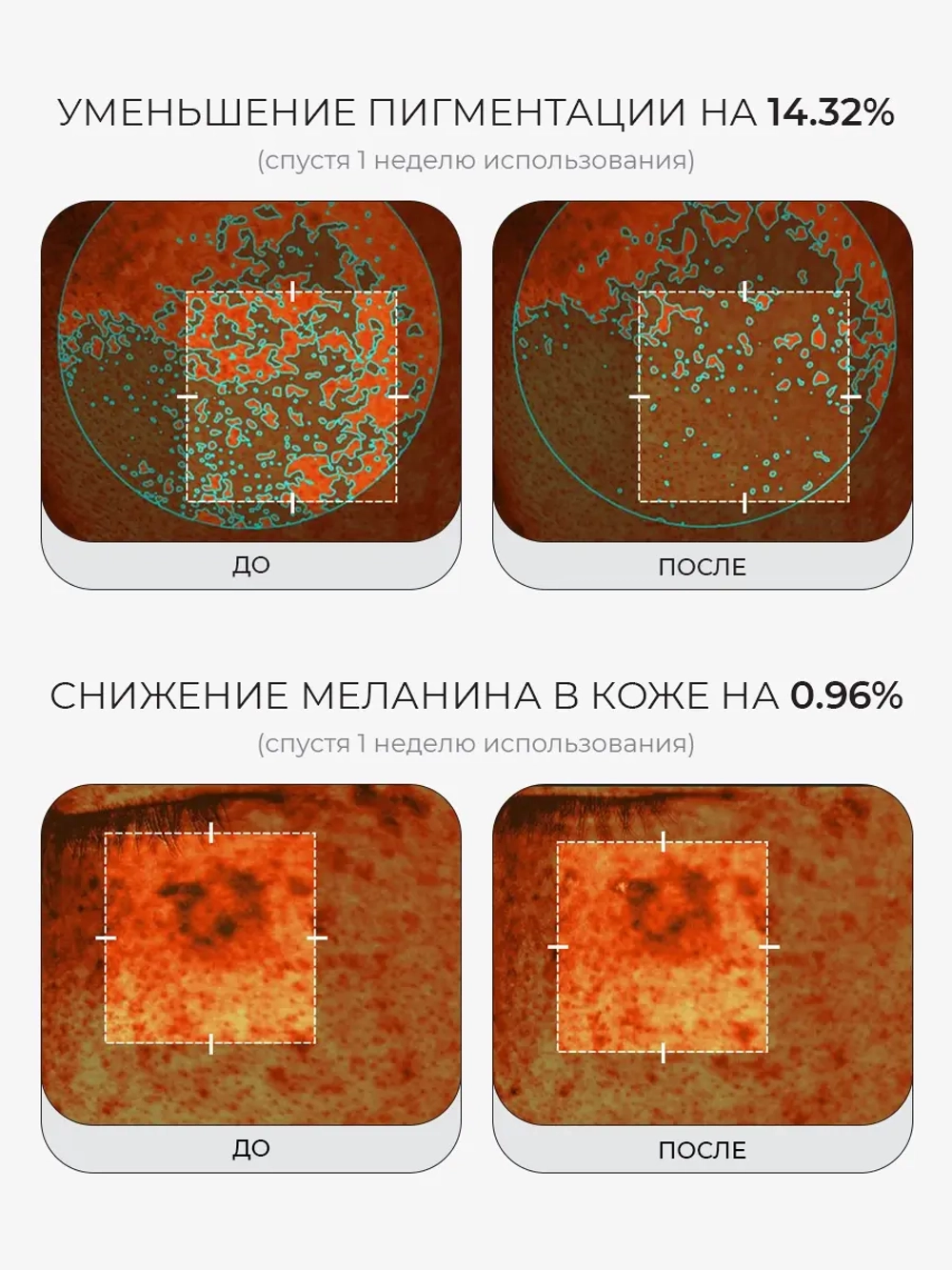 Medicube Ультратонкие гелевые тонер-пэды с ПДРН и коллагеном против пигментации PDRN Pink Collagen Toning Gel Toner Pad 70 шт