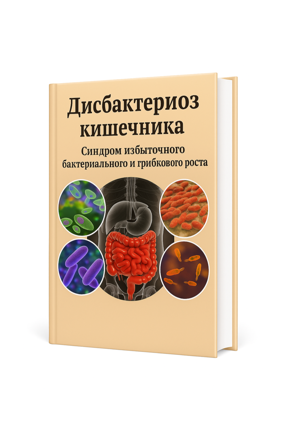 Дисбактериоз кишечника. Синдром избыточного бактериального и грибкового роста