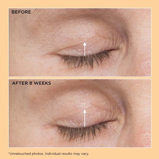 Perricone MD Лифтинг сыворотка для кожи вокруг глаз Neuropeptide Eyelid Lift Serum