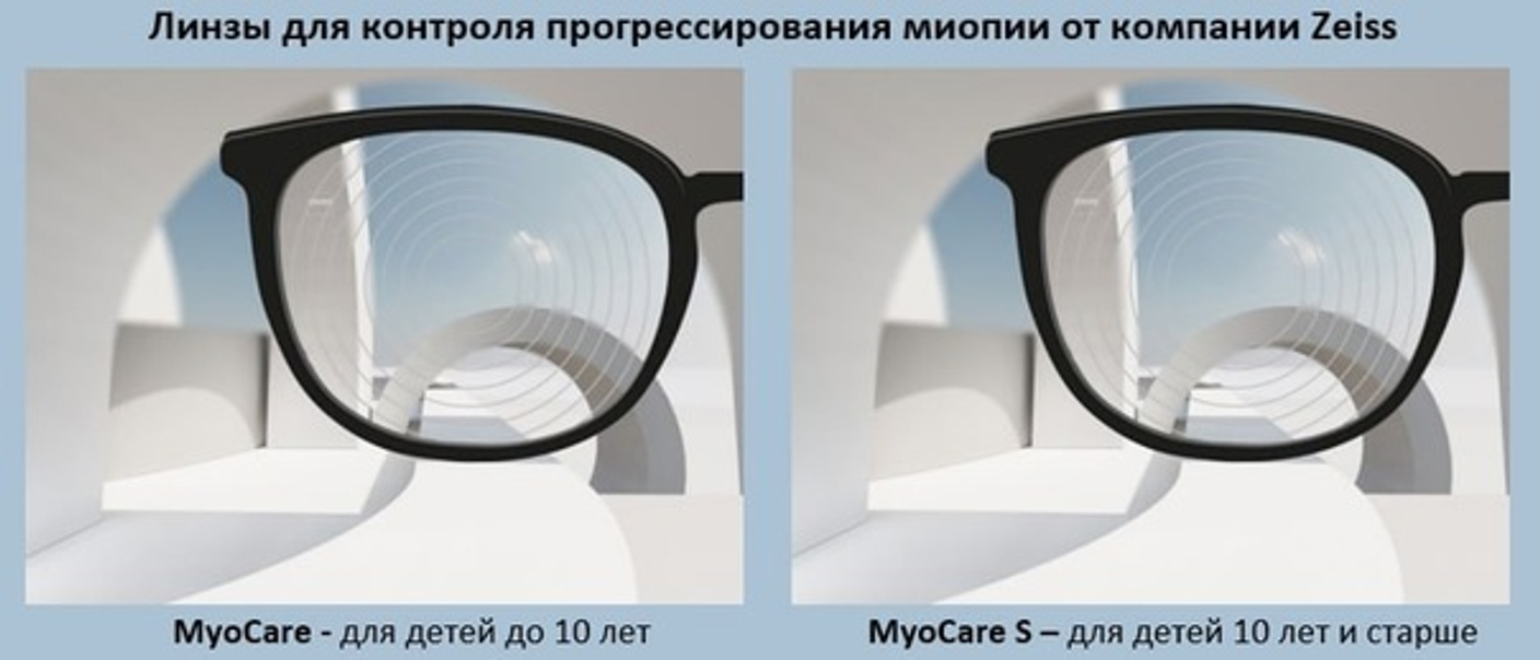 Контроль миопии у детей: инновационные линзы MyoCare от Zeiss и Stellest от Essilor