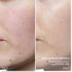 Ампулы для лица "Успокаивающие" BABOR Ampoule Concentrates SOS Calming