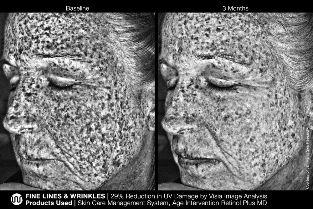 JAN MARINI AGE INTERVENTION RETINOL PLUS MD 1% Крем-акселератор с ретинолом 1% для борьбы с видимыми возрастными изменениями