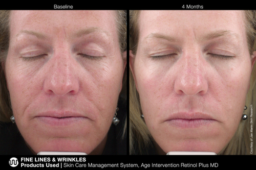 JAN MARINI AGE INTERVENTION RETINOL PLUS MD 1% Крем-акселератор с ретинолом 1% для борьбы с видимыми возрастными изменениями