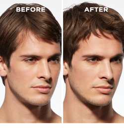 Kerastase Genesis Homme Serum Anti-chute Fortifiant - укрепляющая сыворотка для ослабленных волос со склонностью к выпадению /  dla mężczyzn 90  ml  / GTIN 3474637077495