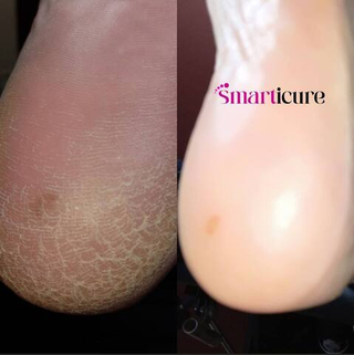 Smart PediPlex 1 - Гель для Smarticure, 200мл