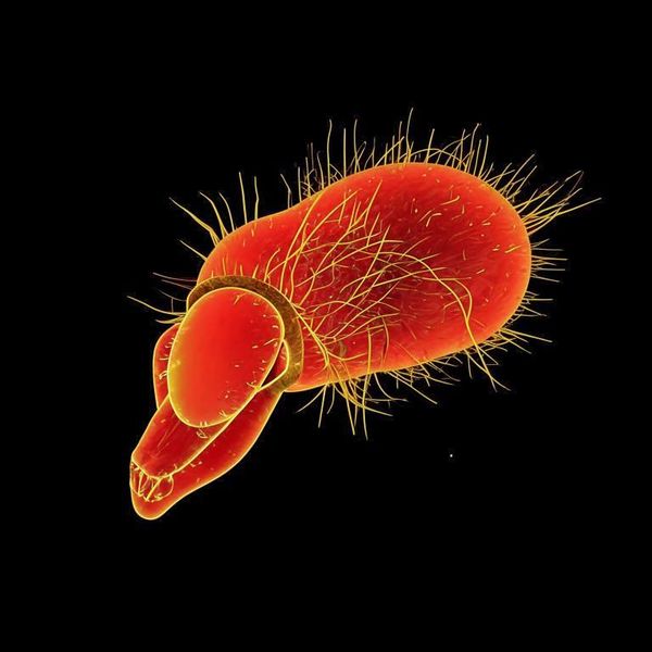 Актиномикоз