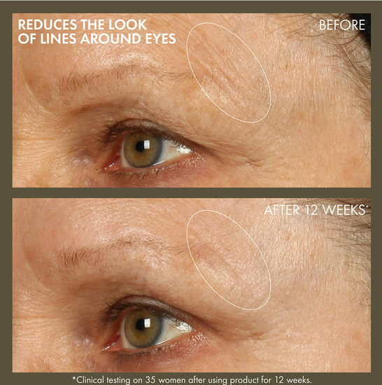 Origins Plantscription Active Wrinkle Correction Serum