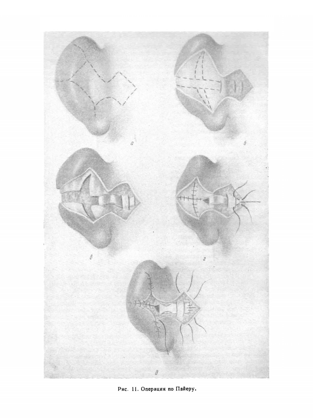 Руководство по оториноларингологии. Болезни уха | А.Г. Лихачев