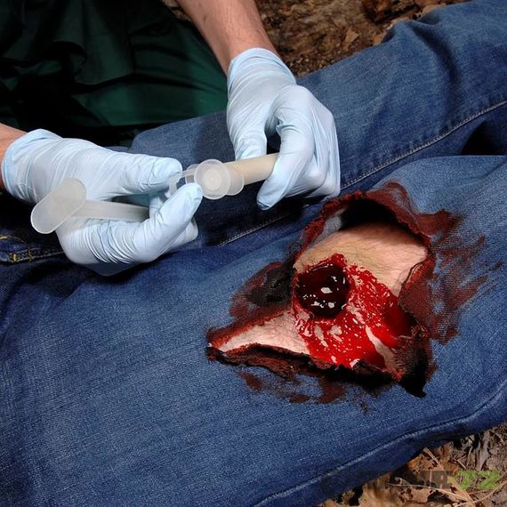 Аппликатор хитозановый гемостатический с гранулами «PRO»