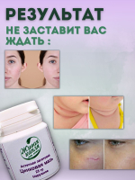 ЦИНКОВАЯ МАЗЬ 10% 25 г