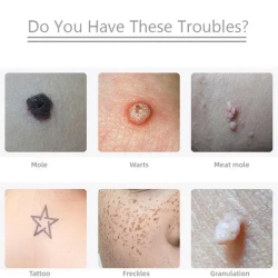 Иголки для лазерной ручки от папиллом и бородавок /10 штук