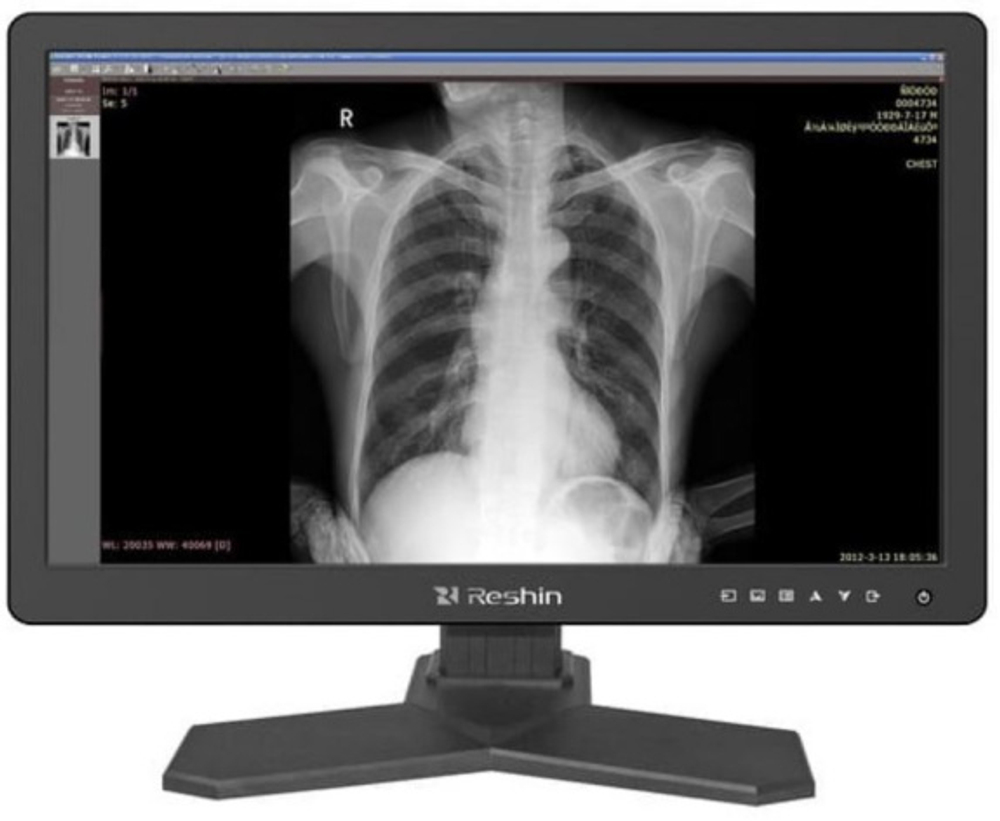 Монитор 24" RESHIN MD26C