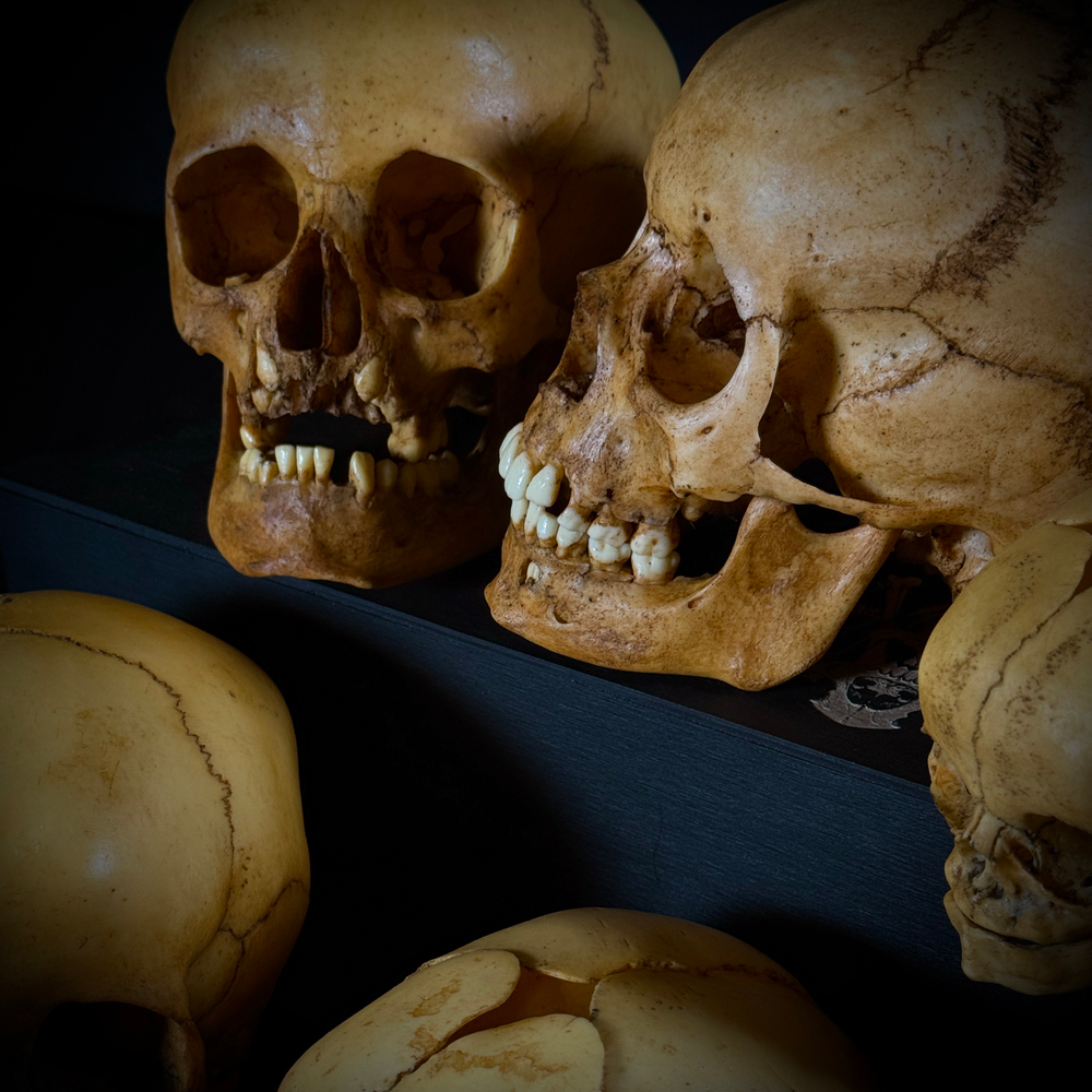 Набор «Череп человека» (анатомические модели)