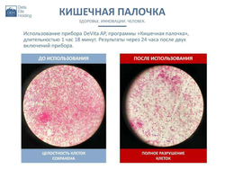 Устройство "DeVita AP + " модель "Mini"