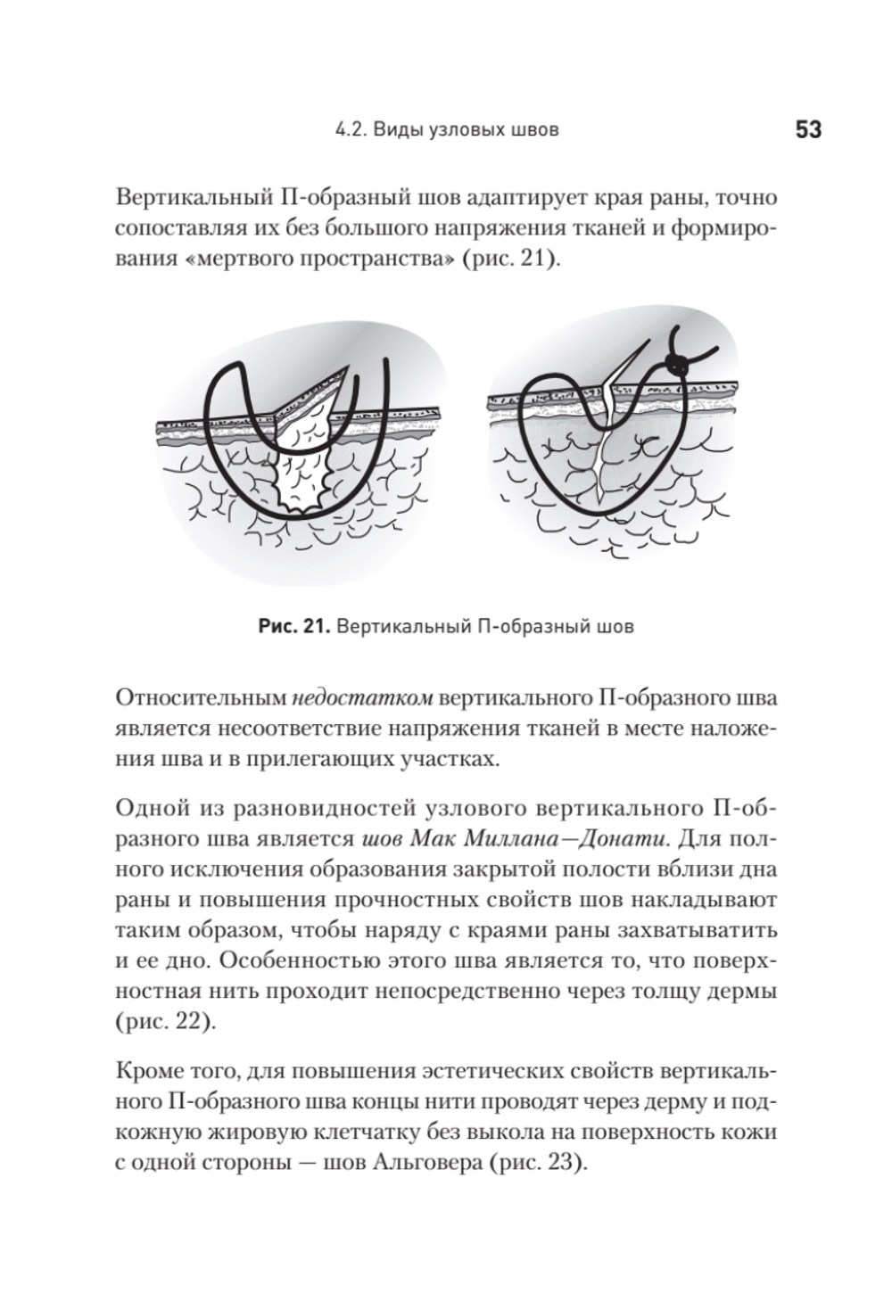 Хирургический шов. 3-е изд., обновленное