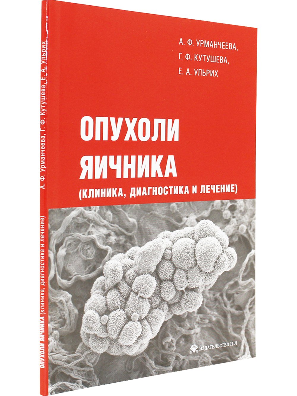 Опухоли яичника (клиника, диагностика и лечение)