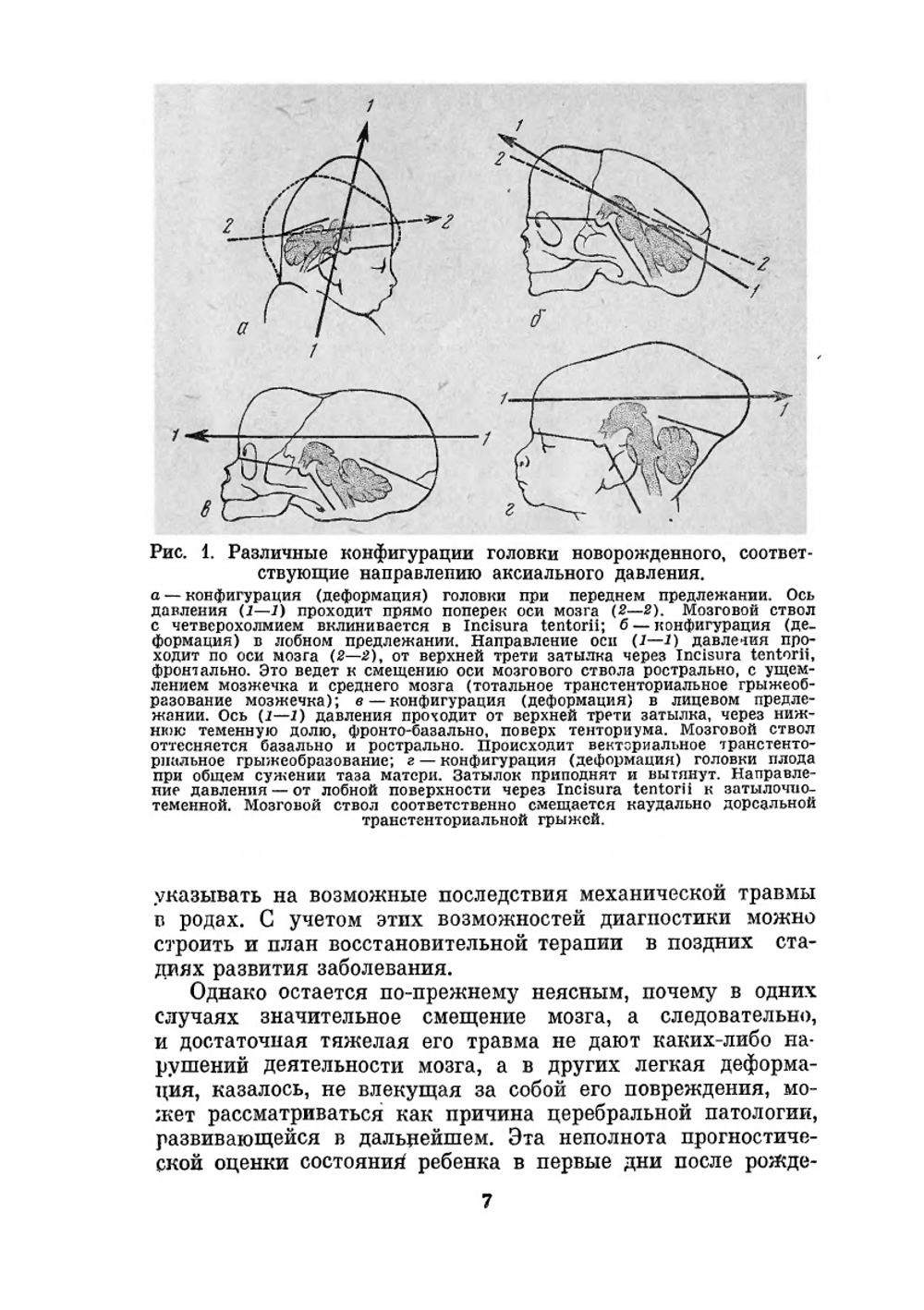 Клиника и реабилитационная терапия детских церебральных параличей | Е.М. Мастюкова; К.А. Семёнова; М.Я. Смуглин
