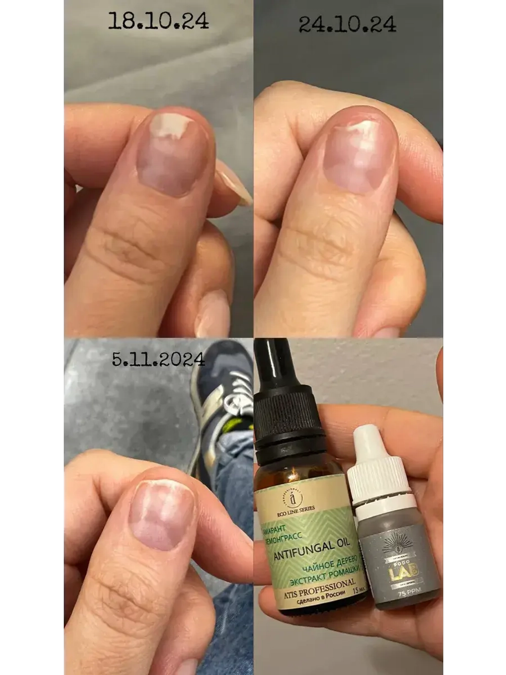 Капли «Сила Серебра» ANTIFUNGAL 250 ppm 5 мл