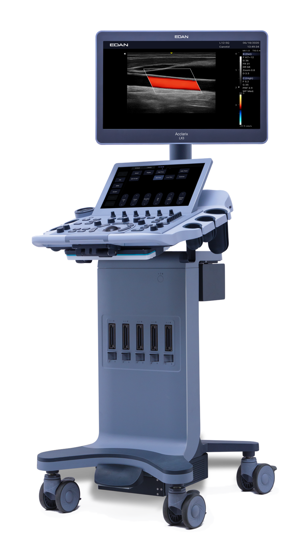 УЗИ аппарат Edan Acclarix LX25