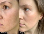 Сыворотка Holifrog Sunnyside C Glow Serum 30 мл