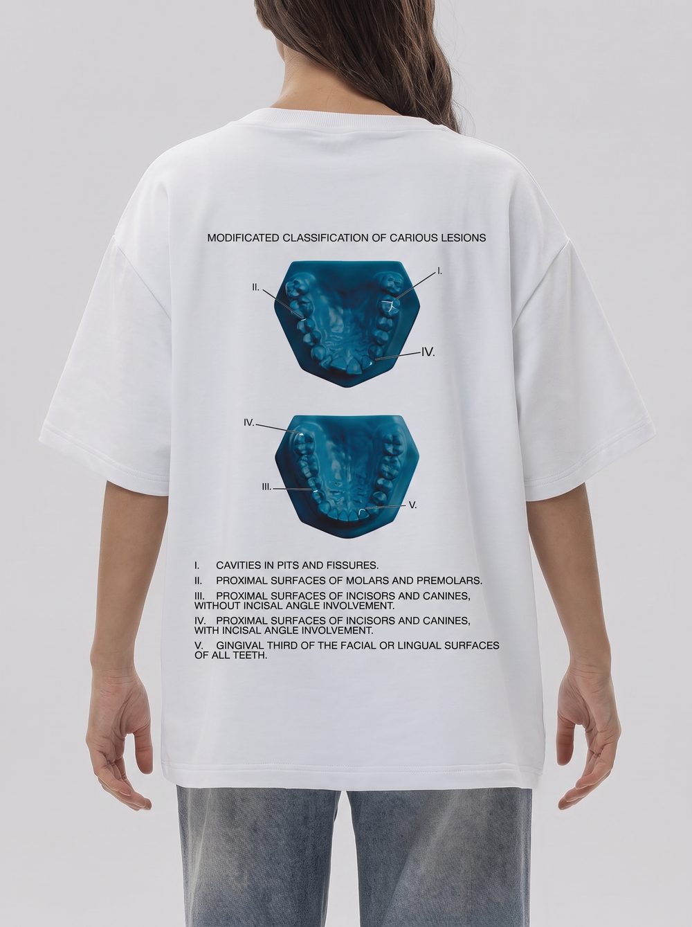 Футболка женская Modified classification of caries