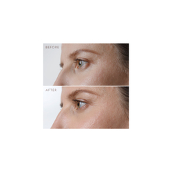 FOREO Iris Firming Eye Serum - омолаживающая сыворотка для глаз /   15  ml  / GTIN 7350120790927