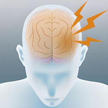 Реабилитация постинсультных больных: проблемы отрасли