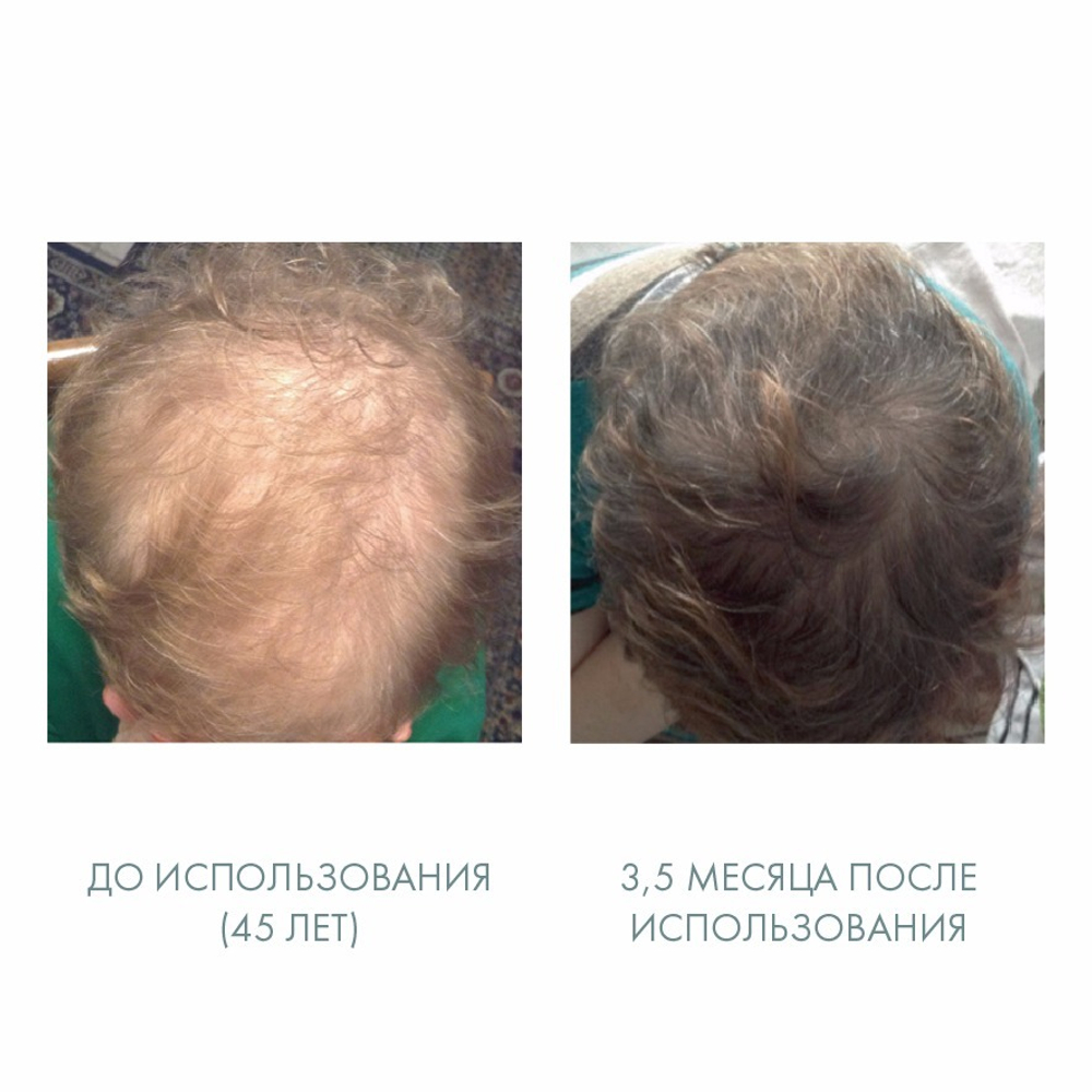 Комплекс для укрепления и восстановления волос SCC5, pH- 4-4,5