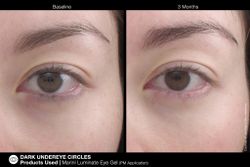 JAN MARINI LUMINATE EYE GEL Концентрированная сыворотка для кожи вокруг глаз с эффектом сияния против темных кругов и морщин