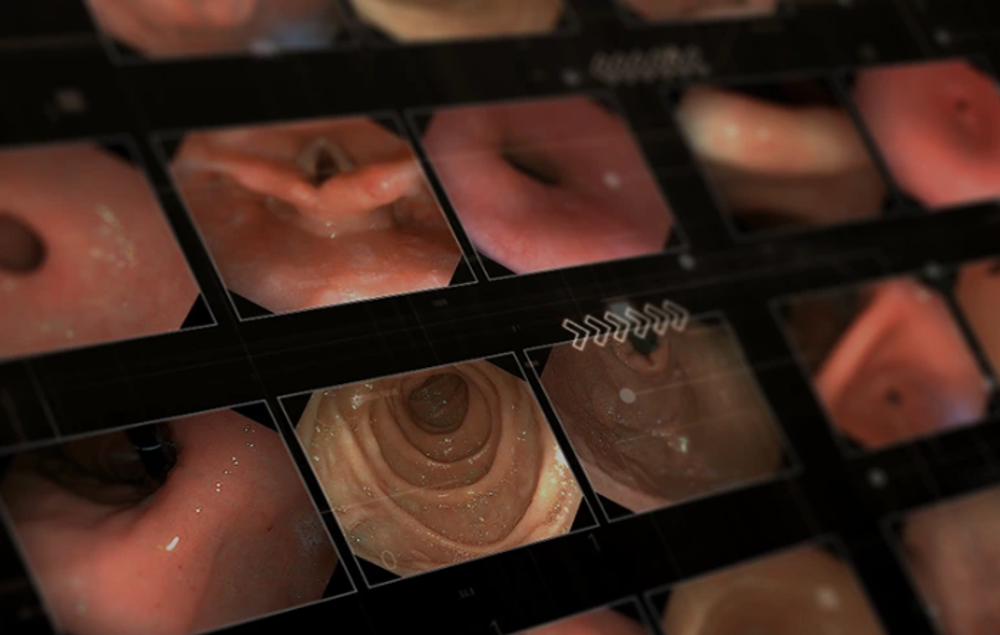 Видеоэндоскопическая система AOHUA AQ-90