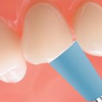 EDENTA 1238RA-100 Полир для профилактики Prophylaxis Pasteless RA, d 6 мм, цвет голубой, форма чаша