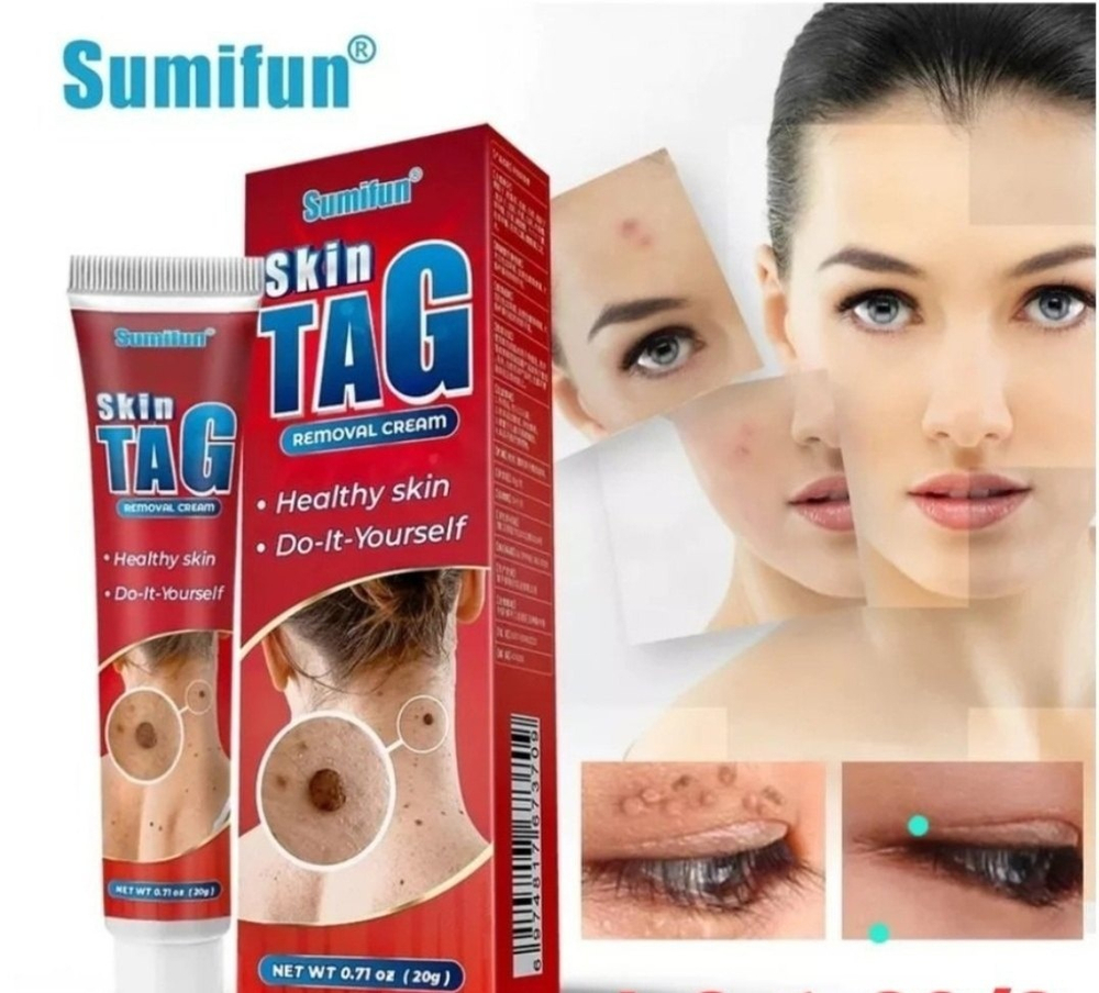 Крем для удаления бородавок и папиллом Sumifun Skin Tag cream 20г