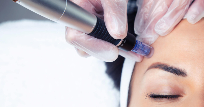 14 ноября, 11:00–17:00 Практический семинар: "Фракционный микронидлинг" 