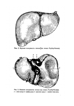 Хирургия желчного пузыря и желчных протоков | И.М. Тальман