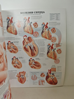 Анатомия человека: болезни и нарушения