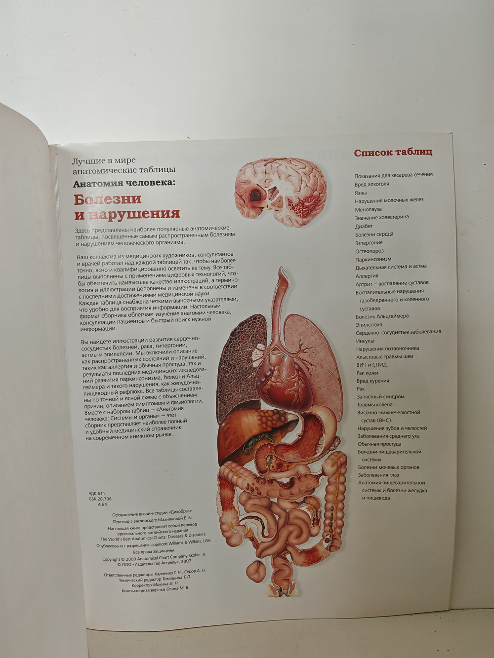 Анатомия человека: болезни и нарушения
