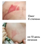 Gana Patch | Ранозаживляющая повязка