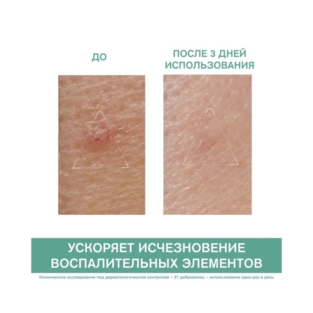 Uriage Hyseac SOS Paste Паста SOS - Локальный уход, 15 г