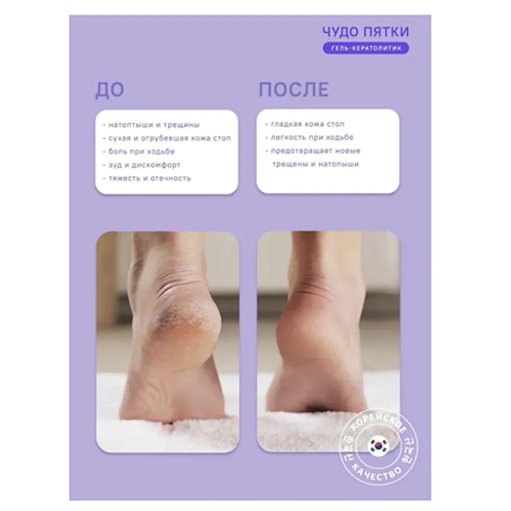 Гель для педикюра «Чудо пятки» SECRETDAY (250 мл.)