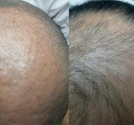 Hair Forest Ampoule Eldermafill | Восстановление волос