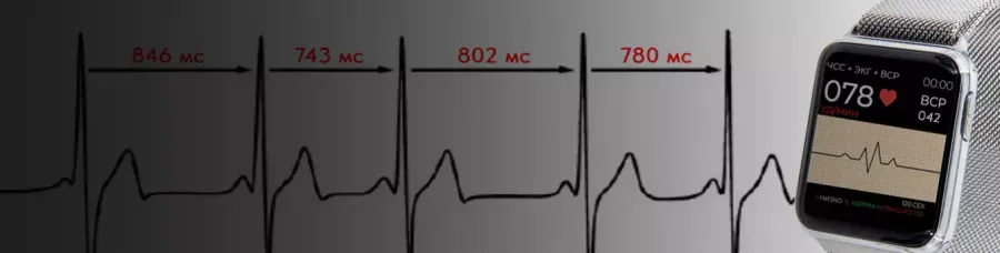 Измерение вариабельности сердечного ритма. Норма HRV и причины отклонений