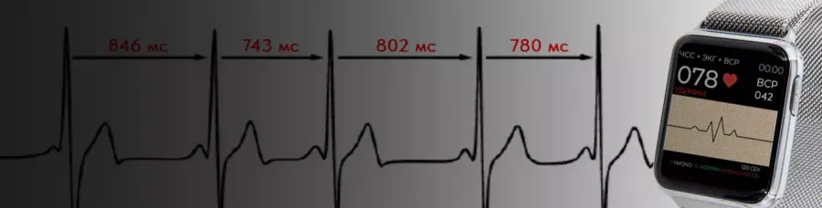 Вариабельность сердечного ритма: норма HRV и причины отклонений