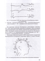 Электрофизиологический мониторинг центральной нервной системы