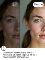 Набор с микроиглами и ретинолом против пигментации