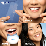 Crest 3D Whitestrips Professional Effects Light — Отбеливающие полоски для зубов: до 12 тонов за 20 дней
