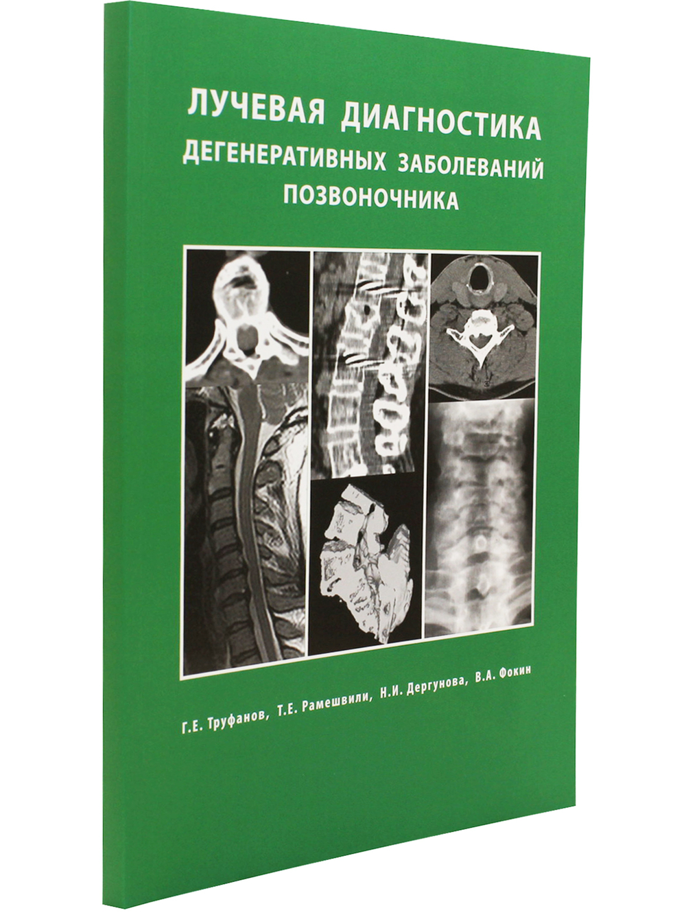 Лучевая диагностика  дегенеративных заболеваний позвоночника 3-е излание
